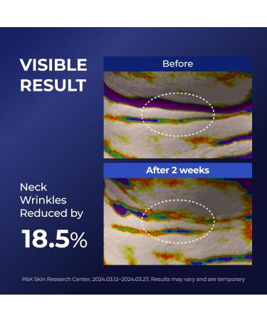 DOMINAS AtClinic Retinol Neck Shot Serum - Neck Pigmentation & Wrinkle Treatment with Retinol 5 Peptides & Vitamin C Sagging Skin Firming & Lifting Korean Skincare 1.01 fl oz - Buy Online on GoSupps.com