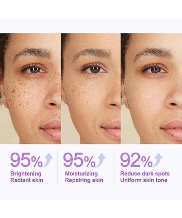 Dark Spot Remover for Face Spot Cream Dark Spot Corrector Skin Lightening Cream Pigmentation Removal Cream Dark Spot Correcting Glow Serum for Melasma Freckle Sun Spot Remover Blemish Reduction - Buy Online on GoSupps.com