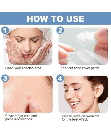Acne Pimple Patches - Absorbing Cover with Tea Tree Oil Invisible Blemish Spot Hydrocolloid Skin Treatment Facial Stickers Five Sizes Blends in with skin - Buy Online on GoSupps.com