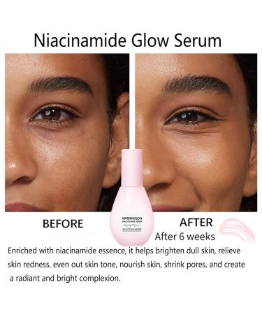Watermelon Niacinamide Moisturizer - Hydrating Facial Serum with Hyaluronic Acid & Vitamin E | Brightening Glow Dew Drops (60ml) - Buy Online on GoSupps.com