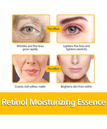  Cynamus Retinol Capsules Night Serum Moisturizing Firming Serum Retinol Serum for Face Anti Aging to Reduce Wrinkles Lightening 30 Capsules - Buy Online on GoSupps.com