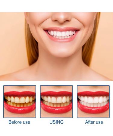 7 Days Tooth Elevator Powder | Organic Tooth Whitening & Stain Removal | Refreshing Mint Flavor - 1PC - Buy Online on GoSupps.com