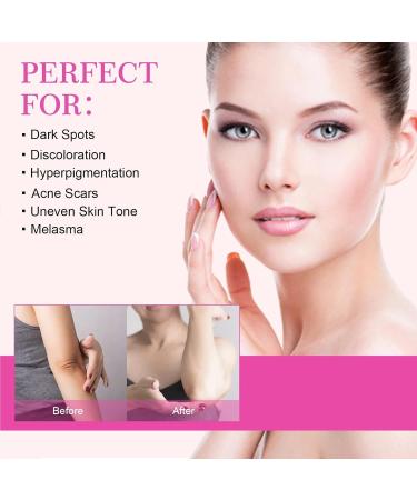 KOAHDE Body Cream for Dark Skin Skin Lightening Cream Body Care Skin Whitening Moisturizing Cream Whitening Cream For Dark Armpit Treatment Underarm Whitening Cream Armpit Whitening Cream 2PC - Buy Online on GoSupps.com