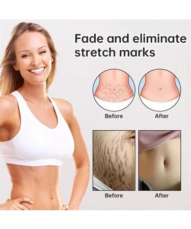 Ampoule Scar Removal Serum - Advanced Medical Grade Scar Repair for All Types of Scars (2BOX) - Buy Online on GoSupps.com