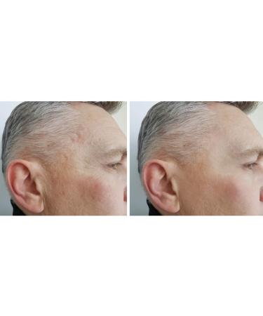 DERMAWORKS Instant Face Lift Serum for Dark Circles, Puffy Eyes & Wrinkles - Buy Online on GoSupps.com