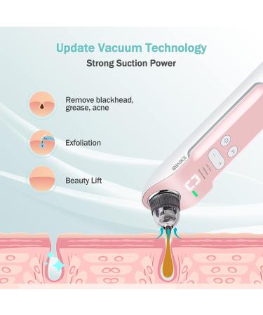 2023 Newest Rechargeable Blackhead Remover Vacuum Cleaner - EZBASICS Pore Vacuum with 3 Suction Levels, LED Display - Pink - Buy Online on GoSupps.com