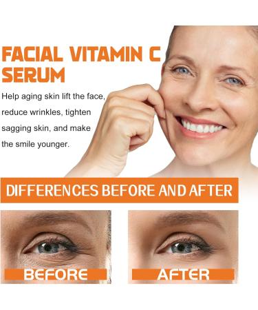 Vitamin C Serum for Face Hyaluronic Acid Serum for Face Vitamin C Serum for Face with Vitamin E & Nicotinamide Fade Aging Wrinkles & Anti Aging Even Skin Tone Lifting Face Moisturiser for Women & Men - Buy Online on GoSupps.com
