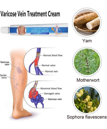 Venoheal Varicose Vein Treatment Cream Relie Vein Treatment Cream Anti-Varicose Vein Treatment for Legs Varicose Vein Care Cream Vein Care Cream for Legs Pen & Cream - Buy Online on GoSupps.com