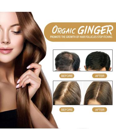 Pemarlis 2 Pack Shampoo Bar Anti Hair Loss Shampoo Shampoo Bar Natural Cosmetic Ginger Shampoo Hair Growth Shampoo Bar for Hair Growth for - Buy Online on GoSupps.com