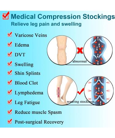 Open Toe Thigh High Medical Compression Stockings 20-30 mmHg for Men & Women - Relief for DVT Varicose Veins Shin Splints & Swelling - Medium Black - Buy Online on GoSupps.com