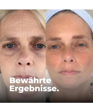  Vaud VAUD Anti-aging Capsules for Skin Hair and Nails - Anti-Wrinkle - 90 Capsules - Highly concentrated with Fucus Vesiculosus Viola Tricolore and Zinc - Natural - Laboratory tested - Made in - Buy Online on GoSupps.com