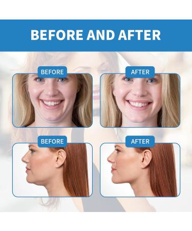 XdealCozyxc Double Chin Mask Lift V Shape Lifting Firming Hydrating Anti-Aging - Buy Online on GoSupps.com