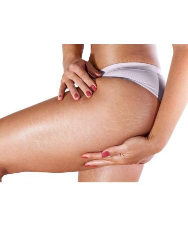Hot Effect Gel Lipo Reducer Anti Cellulite - Thermo Active Gel Muscle Warm-up Sport 200ml - Slimming Thermal Gel - Anti-pain Heating Gel (back joints) - Buy Online on GoSupps.com