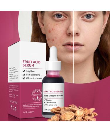  Wisylizv Fruit Acids for Skin - 30ml Liquid with Pore Minimizer | Skin Care Brightening Oil Complex Acid Serum | Pore Refiner | Skin Tone Corrector - Buy Online on GoSupps.com