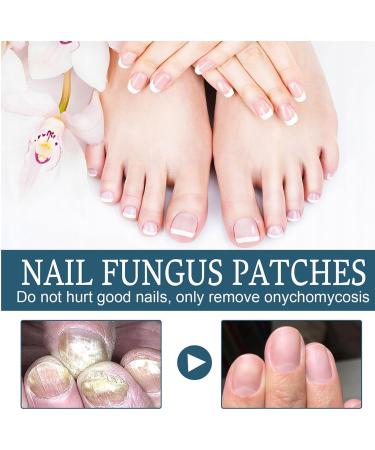 Solution de soin des ongles gris pour les mains et les pieds r paration des ongles solution de renouvellement des ongles aide r duire la d formation des ongles douce et nourrissante 30 ml pour - Buy Online on GoSupps.com