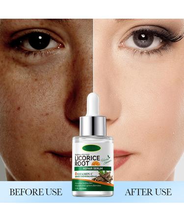 Licorice Root Extract for Skin - Licorice Root Serum Licorice Root Oil Drops Moisturizing Face Oil Licorice Root Extract Anti-Shrinking Pores Face Oil (2Bottle) - Buy Online on GoSupps.com