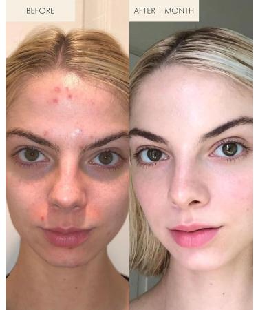 MARA - 1.2% Clean Retinol Face Oil for Anti-Aging + Wrinkles with Algae + Green Tea | Vitamin-Rich Serum to Plump Skin Overnight For All Skin Types (0.5 fl oz | 15 ml Travel Size) 0.5 Fl Oz (Pack of 1) - Buy Online on GoSupps.com