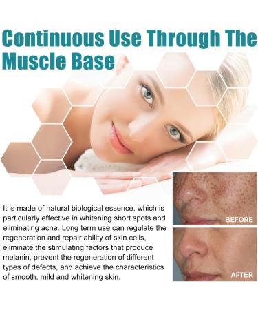Cr me claircissante pour les taches de rousseur cr me anti-taches la niacinamide cr me blanchissante pour la peau avec vitamine C contre les taches sombres cr me claircissante pour un teint - Buy Online on GoSupps.com