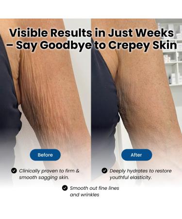 Elir Firming Duo Neck Cream + Crepe Fix Body Moisturizer Complete Skincare Set for Firmer Smoother Neck Arms & Body Fast-Absorbing Hydrating & Non-Greasy Dermatologist-Tested - Buy Online on GoSupps.com