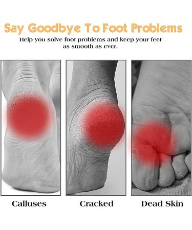 Nano Glass Foot File Callus Remover - Professional Pedicure Tool for Wet & Dry Feet Care - Exfoliate Dead Skin & Cracked Heels (Gold - Buy Online on GoSupps.com
