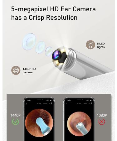 Bebird Pro Ear Wax Removal Tool with 1440P HD Camera and 6 LED Lights - FDA Approved Ear Cleaner for Smaller Ears - Pink - Buy Online on GoSupps.com