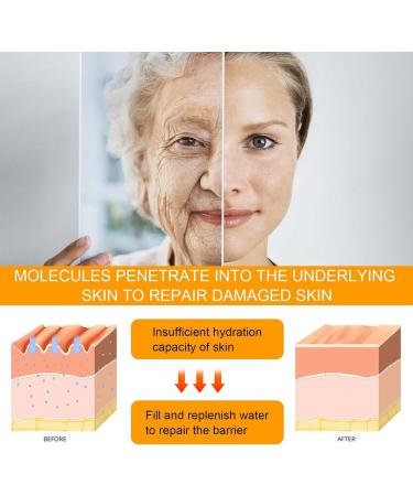 XINRAN 5D Peptide Eye Cream Eye Wrinkle Cream Moisturizing Eye Creams Deep Invigorating Peptide Eye Creams Skin Under Moisture Nourishing Serum Antis Wrinkle Care Dark Circles 4 Pack - Buy Online on GoSupps.com