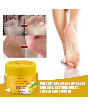 Moisturizing Foot Cream Fast-Absorbing Cracked Skin Treatment & Callus Remover 2PCS Yellow Ointment for Rough Heels - Buy Online on GoSupps.com