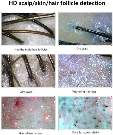 Hair Follicle Facial Skin Oil Moisture Tester Skin Hair Scalp Detector with 11 Inch 200x Lens 50x Lens Pixels 1000W ABS Resin Hair Follicle Testing and Skin Analysis Magnifier - Buy Online on GoSupps.com