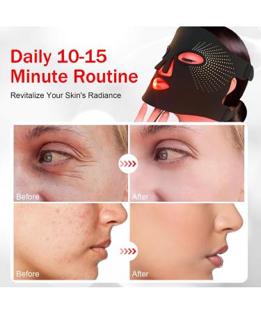USUIELIGHT Led Face Mask Light Therapy 3 Colors Led Mask Face Mask LED Facial Mask Suitable for All Skin Types for Facial Care Black - Buy Online on GoSupps.com