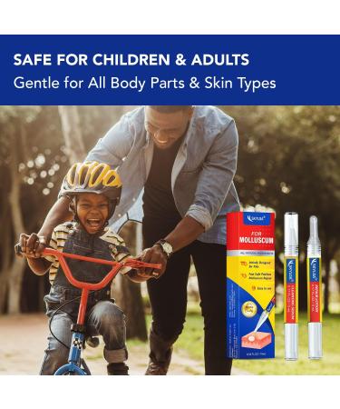 Skyloa Molluscum Contagiosum Treatment Pen | Safe & Painless Repair Kit for Kids and Adults | 10mL/0.34 FL.OZ - Buy Online on GoSupps.com