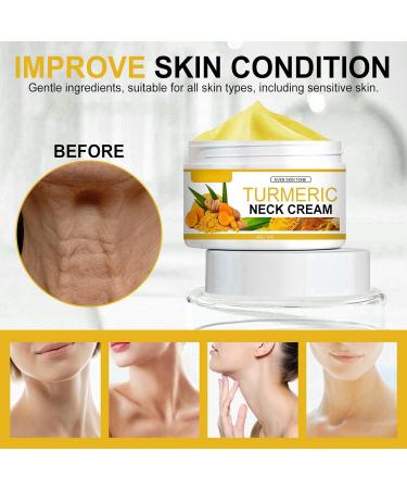 Turmeric Neck Firming Cream Neck Tightening Cream Face Firming Cream Natural Neck Cream Retinol Neck Cream for Sagging and Tightening Natural Turmeric Anti Aging Cream Reduces Fine Lines Cream - Buy Online on GoSupps.com