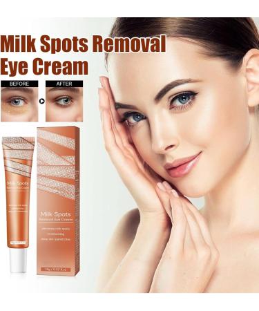 KOAHDE Milia Spot Remover Eye Creams Dark Circles Remover Lightens Cream Moisturizing Milia Eyes Cream Eye Creams Ruduce Milia Milia Removal Eye Creams Speedy Milia Remover Eye Cream 1PC - Buy Online on GoSupps.com