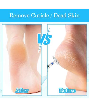 Jeffdad 3-Piece Nail Miller Bits Set | Professional Electric Foot File & Hard Skin Remover | Gel & Acrylic Nail Grinder | Durable 4.2 x 1 x 1 cm - Buy Online on GoSupps.com