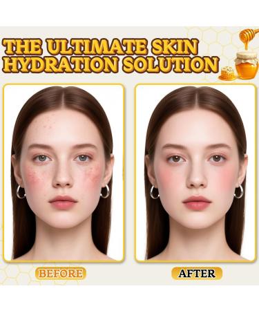 YOURTONE Beef Tallow for Skin Tallow and Honey Balm for Face Grass-Fed Beef Tallow Face Moisturizer Deeply Moisturizing for Dry & Sensitive Skin (4.23oz/120g) - Buy Online on GoSupps.com