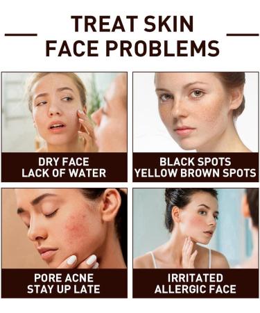 Gla-Mory Micros-Infusions System for Face Gla-Mory Micro-Infusions System for Lips Hyaluronic Acid Serum for Face Smooth Skin Facial Serum Gla-Mory Facial System Hydrating Serum for All Skin 10ml - Buy Online on GoSupps.com