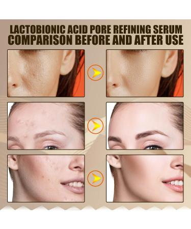 Lactobionic Acid Pore Refining Serum Lactobionic Acid Pore Shrink Face Serum Pore Refining Serum Reduce Fine Lines Facial Liquid Anti-Wrinkle for All Skin (60ml) - Buy Online on GoSupps.com