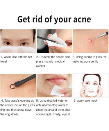 3-Piece Blackhead Removal Kit - Double Stainless Steel Comedone Extractor Tool for Acne & Blemish Treatment - Buy Online on GoSupps.com