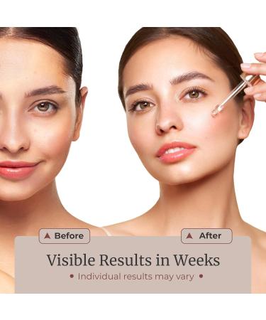 LF Laboratories Radiant Glow Vitamin C Serum with Retinol Peptides Niacinamide & Hyaluronic Acid Brightening & Anti-Aging Face Serum for Dark Spots & Fine Lines 1 fl oz / 30 ml - Buy Online on GoSupps.com