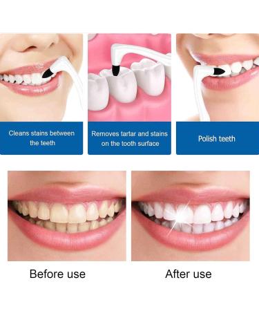 Buy Lacymc 3-Piece Tartar Remover Set | Teeth Whitening & Stain Removal | Effective Plaque & Tartar Cleaning - Buy Online on GoSupps.com
