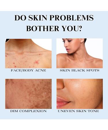 Turmeric Soap Bar Vitamin C Natural Soap Ginger Handmade Soap Moisturising Turmeric Brightening Soap for Body Hand Face Refreshing Cleansing Soap Bars Cleaning Bar Soap for Hyperpigmentation - Buy Online on GoSupps.com