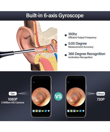 ASHINER Ear Wax Removal Kit with 1080P Camera and LED Lights - Child-Friendly Earwax Cleaner Tool for Kids - Wireless Ear Pick Endoscope for Smartphone Compatibility - Buy Online on GoSupps.com