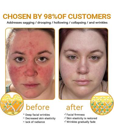 Bee Venom Comprehensive Cream Professional Bee Venom Skin Treatment Cream bee venom All-in-One Cream-50G Anti-Aging Hydrating Natural Ingredients for All skin Types (1 Bottle) - Buy Online on GoSupps.com