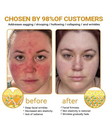 Bee Venom Cream Bee Venom Rapid Skin Repair Cream Bee Venom Skin Treatment cream Effective In Reducing skin Blemishes Gentle and Non-irritating for All Types (2PCS) - Buy Online on GoSupps.com