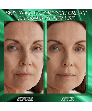 Xionghonglong Fubsta Advanced Firming & WrinkleReducing Cream Fubsta Skin Firming Rejuvenating Cream Fubsta Luxelift Skin Firming Rejuvenating Butter Fubsta Anti Wrinkle Firming2 stuks - Buy Online on GoSupps.com