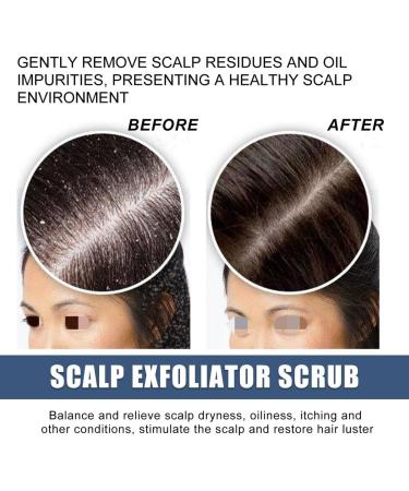 Scalp exfoliating scrub Cleanses scalp and moisturizes dry hair - Buy Online on GoSupps.com