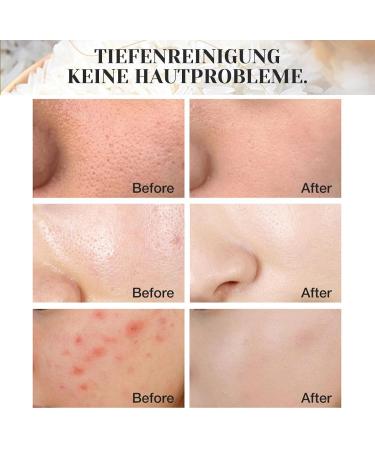 Shefave Rice Cleansing Foam Natural Cosmetics Facial Cleansing for Deep Pore Cleansing for Normal and Combination Skin Care Foam Against Blemished Skin on the Face - Buy Online on GoSupps.com