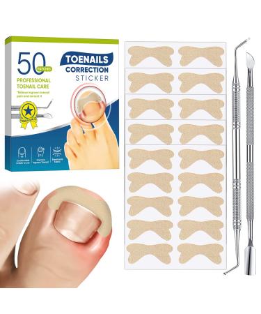 Ingrown Toenail Treatment  50Pcs No Glue Ingrown Toenail Corrector Patch  Ingrown Toenail Removal Kit with File and Lifter  Professional Painless Pedicure for Toenail