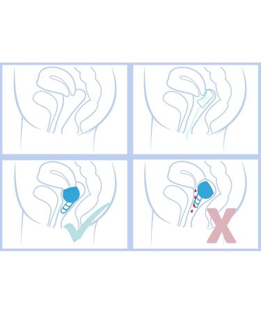 Merula Cup Mermaid (Blue) - One Size Medical Silicone Menstrual Cup | Eco-Friendly & Comfortable International Shipping - Buy Online on GoSupps.com