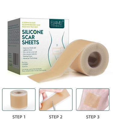 Silicone Scar Sheets Roll-3M (1.6 x 120) for Surgery Burn Keloid Acne - Professional Reusable Strips for C-Section - Scar Removal Tape - Buy Online on GoSupps.com