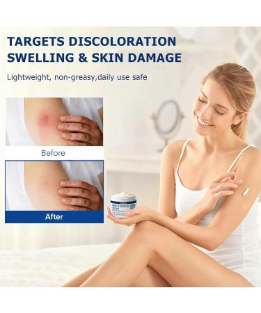 Arnica Bruise Cream Extra Strength Fast-Acting for Bruising & Swelling on Thin Skin - Advanced Formula with Arnica Montana Vitamin K C & E - Soothing Hydrating for Face and Body 1pcs - Buy Online on GoSupps.com